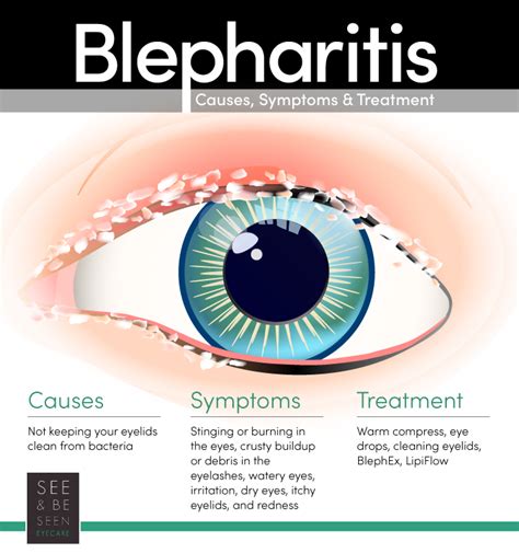 Blepharitis causes