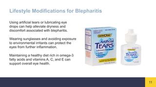 Blepharitis support