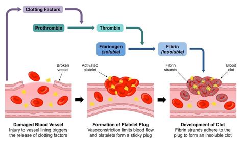 Blood clot formation after molar extraction