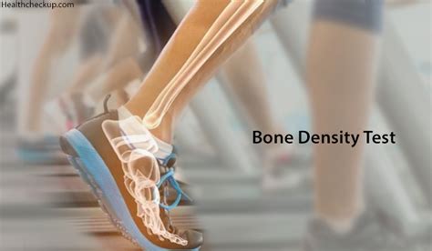 Bone Density Tests