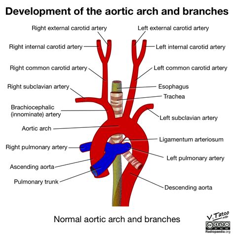 A detailed illustration of branch anatomy