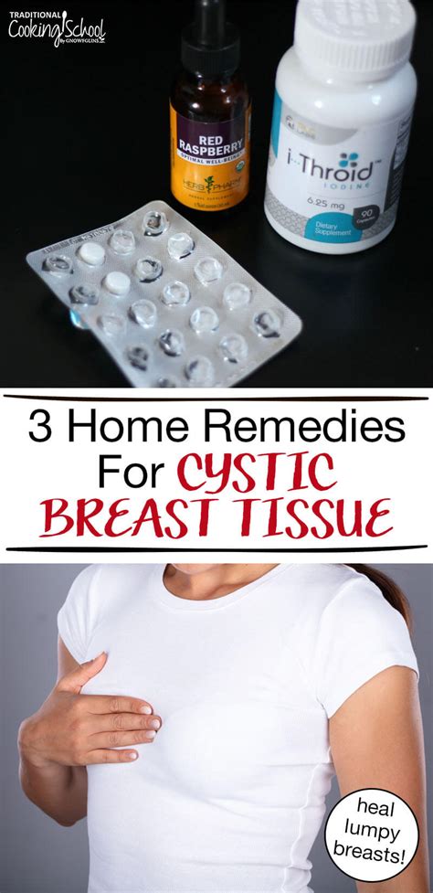 Breast Cyst Remedies