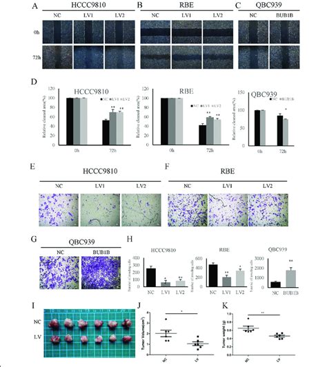 Molecular mechanisms of Bub1b in appendicitis