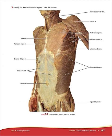 Image of cadaver human anatomy