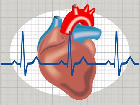 Cardiac arrhythmias