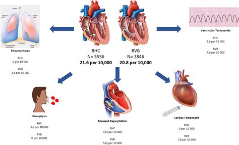 Cardiac Catheterization Risks