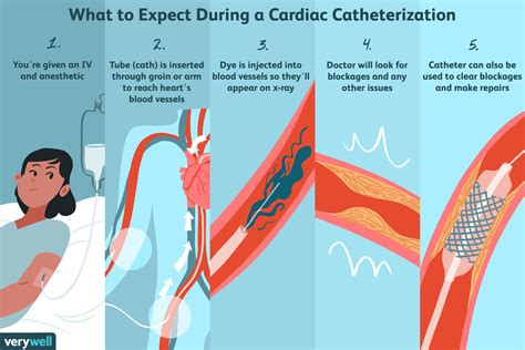 Cardiac Catheterization Techniques