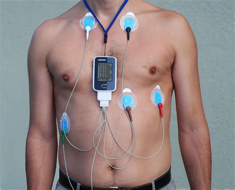 Cardiac Holter Monitor