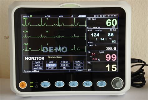 Cardiac Monitoring System