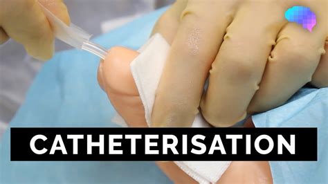 Catheter Insertion Technique