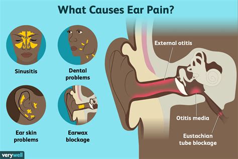 Causes of Ear Pain and Jaw Pain