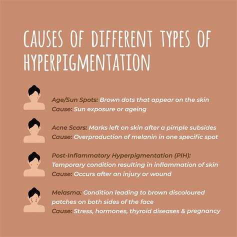 Causes of Hyperpigmentation