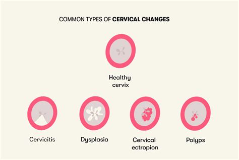 Description of Cervical Abnormalities Image 7