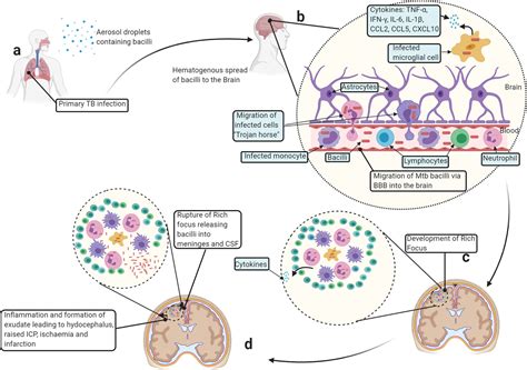 Challenges and Limitations of Meningitis Supportive Therapy