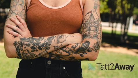 Chest tattoo removal options