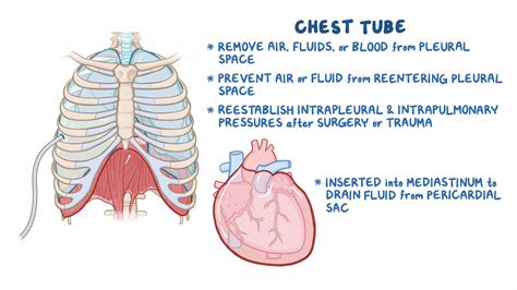 Chest tube care