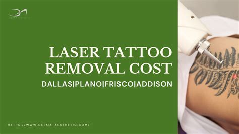 Choosing the right tattoo removal expert