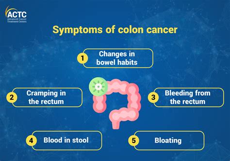 Colon cancer illustration