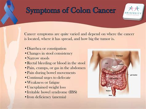 Colon cancer risk factors