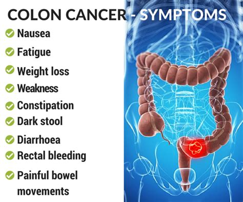 Colon cancer diagnosis