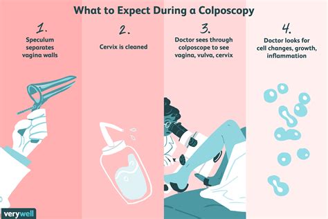 Description of Colposcopy