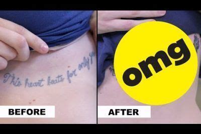 Common mistakes tattoo cover-up patches