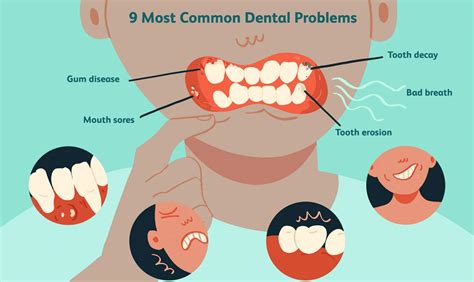 Common Oral Health Problems