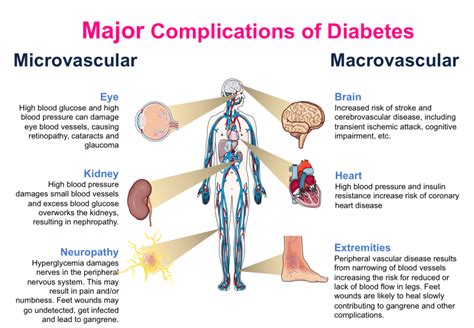 Komplikasi Diabetes Mellitus