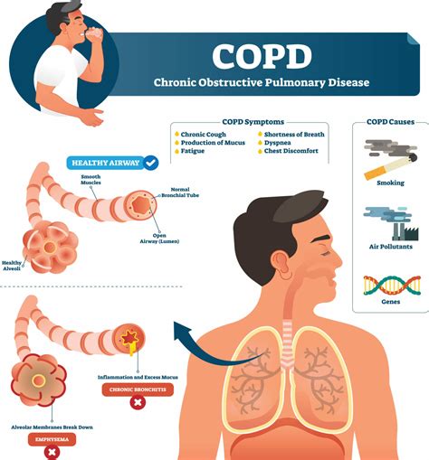 COPD Education