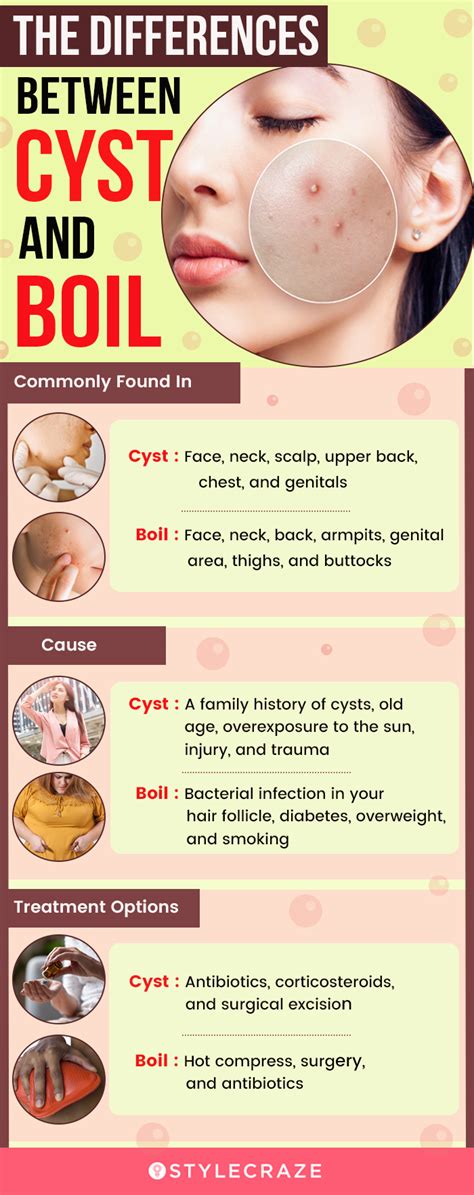 Cyst Prevention