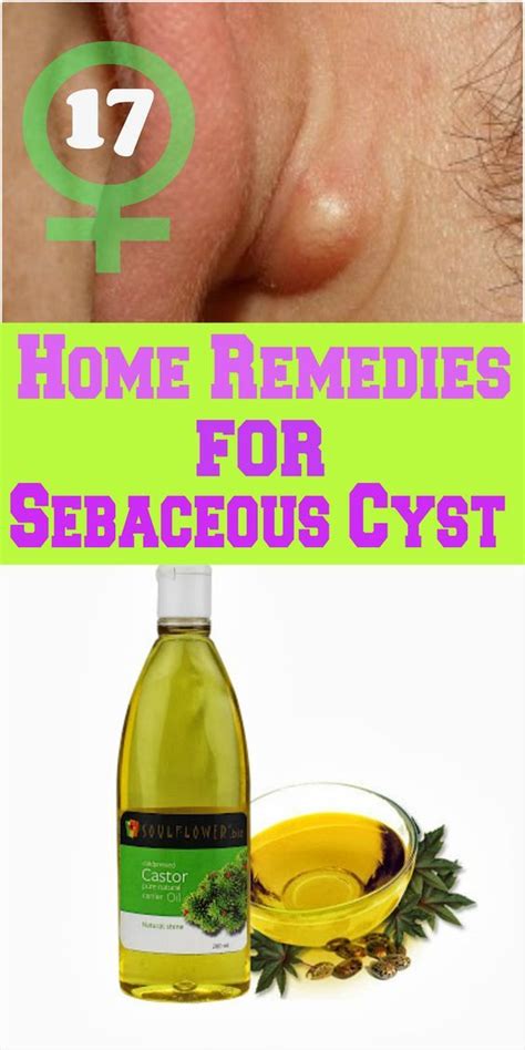 Cyst Remedies and Therapies