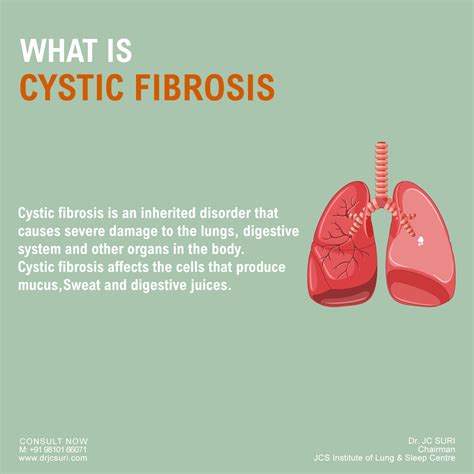 Cystic fibrosis is a disqualifying medical condition for military service