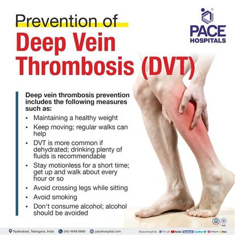 Description of Deep Vein Thrombosis Prevention