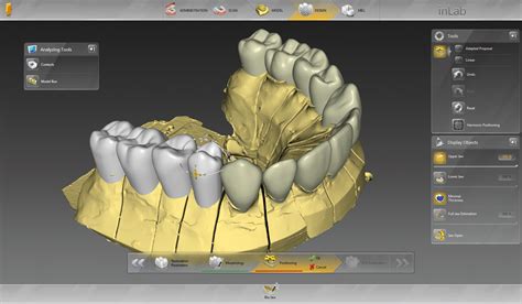 Dental Lab Technician Software