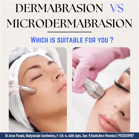 Cost of dermabrasion