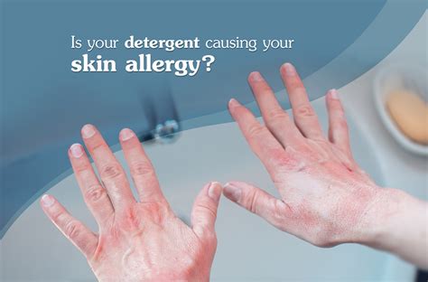 Detergent allergy rash self-care tips