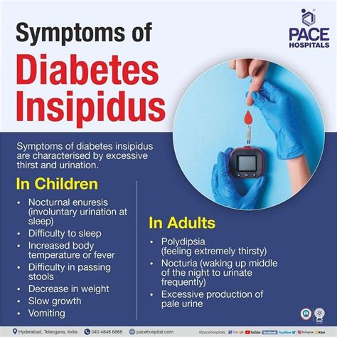 Understanding Diabetes Insipidus