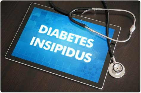 Diabetes Insipidus Management