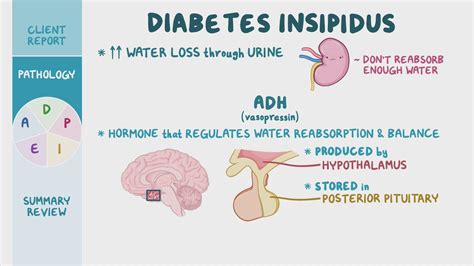 Diabetes Insipidus Desmopressin