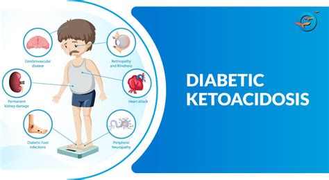 Diabetic ketoacidosis is a serious complication of diabetes