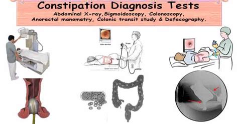 Diagnosing Constipation