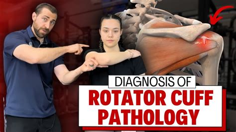 Diagnosing Rotator Cuff Injuries