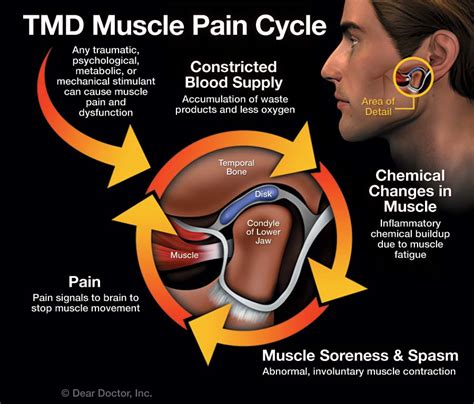 Diagnosing TMJ