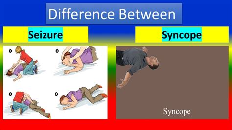 Difference Between Syncope and Seizure Image