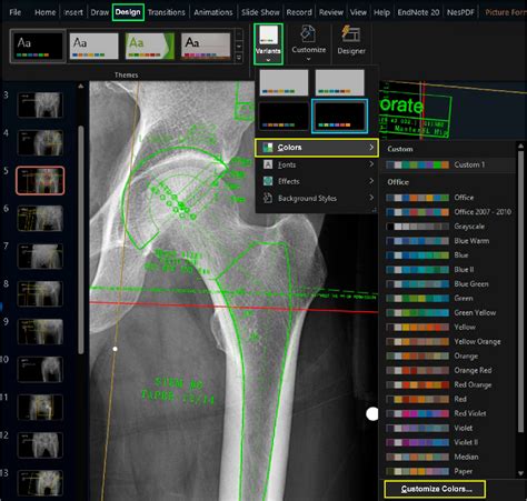 Digital Templating Software