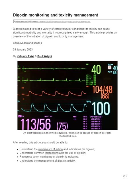 Digoxin Monitoring