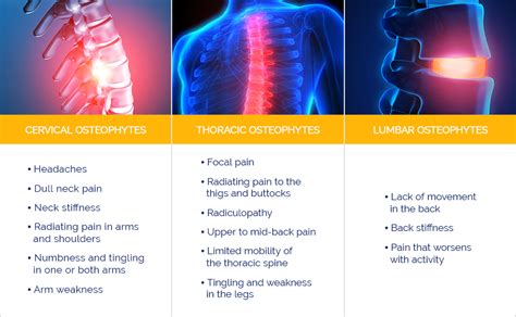 Disc Osteophyte Complex Formation Treatment