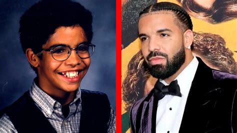 Drake before and after photos