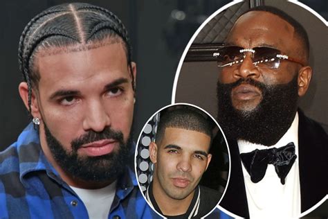 Drake nose surgery rumors