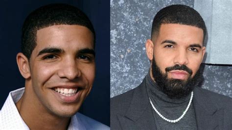 Drake plastic surgery rumors